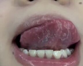 Mouth Uvula 10