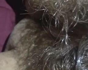 VERY Hairy FART FETISH Slut Shows Hirsutism Hirsute Hairest Pink Pussy stinky Nasty Gross farting