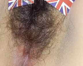 England Hairy